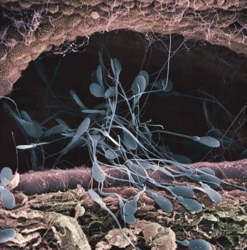 膀胱,睾丸,阴囊,尿道,无人,竖图,室内,白天,正面,仪器,检查,反射,分析,科学,纹路,纹理,显微镜,精子,观察,清晰,探索,放大,观看,仔细,透镜,凸透镜,聚焦,关注,泌尿系统,前列腺,肌理,光学,清楚,附睾,内生殖器,排泄器官,外生殖器,生殖细胞,输精管,精囊腺,尿道球腺,射精管,显微图片,单倍体生殖细胞,雄配子,雄性生殖细胞,雄性细胞,彩图,扫描电镜,扫描电子显微镜,男性生殖系统,生殖器官