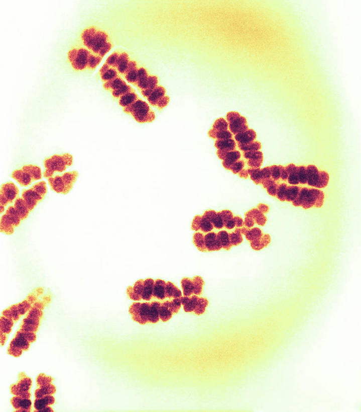 无人,竖图,室内,白天,正面,仪器,微生物,检查,反射,分析,科学,基因,细胞核,血球,染色体,细胞,显微镜,观察,生物,清晰,探索,遗传,放大,观看,仔细,透镜,生物学,脱氧核糖核酸,血细胞,凸透镜,聚焦,关注,蛋白质,白细胞,光学,清楚,核糖核酸,染色质,遗传信息,遗传因子,遗传学,白血球,显微图片,彩图,免疫细胞,白血细胞,扫描电镜,扫描电子显微镜