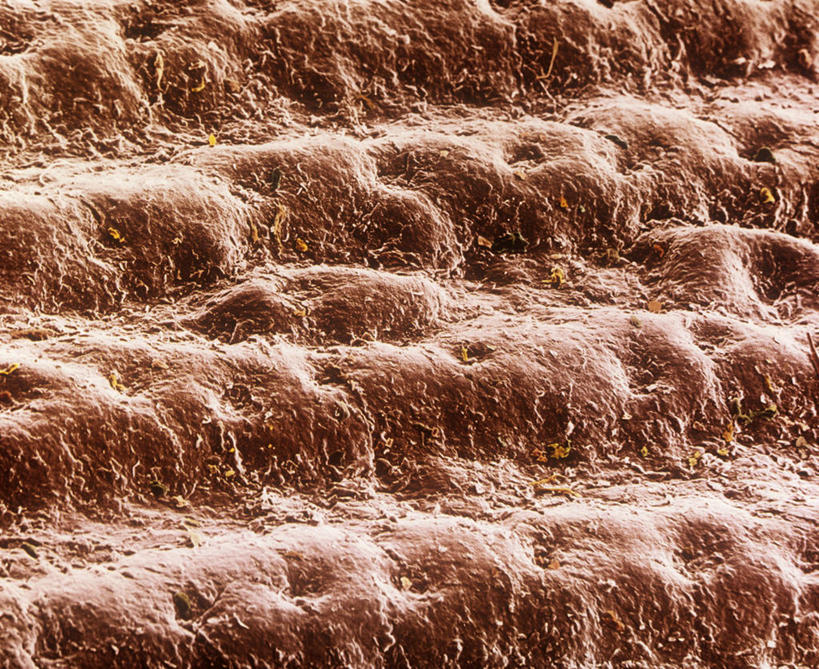 无人,横图,室内,白天,正面,仪器,检查,反射,分析,科学,纹路,纹理,显微镜,观察,清晰,探索,放大,观看,仔细,透镜,凸透镜,聚焦,关注,腺体,肌理,光学,清楚,显微图片,汗腺,彩图,扫描电镜,扫描电子显微镜,皮肤腺