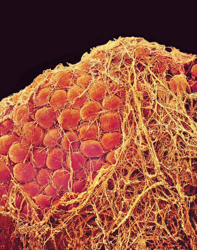 无人,竖图,室内,白天,正面,仪器,微生物,黑色背景,检查,反射,分析,科学,医学,细胞,显微镜,观察,清晰,探索,放大,观看,仔细,纤维,透镜,生物学,凸透镜,聚焦,关注,光学,清楚,脂肪细胞,结缔组织,显微图片,自然科学,博物学,生物科学,彩图,组织细胞,扫描电镜,扫描电子显微镜,基本组织,基质,细胞外间质,甘油三酸酯,甘油三酯,三月桂精,月桂脂