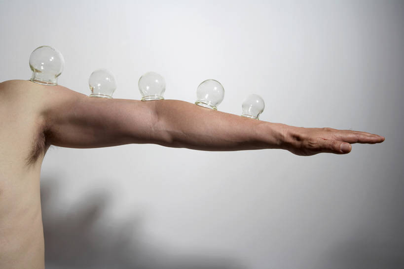 东方人,成年人,中年人,一个人,病人,医院,横图,室内,留白,白色背景,杯子,北京,中国,亚洲,朦胧,模糊,医学,墙,文化,传统,裸露,健康,治疗,吸,保健,摄影,部分,真空,医疗,疾病,关爱,中国文化,裸,医疗工具,拔火罐,中医,火罐,东亚,医治,替代疗法,解决,拔罐,拔罐疗法,拔罐子,火罐疗法,中医学,男人,男性,中年男性,亚洲人,中国人,手臂,捧着,彩图,影棚拍摄,奖杯,传统文化,门诊部,物理疗法,bj175